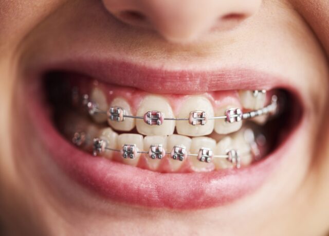 orthodontists and dentists