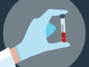 How Much Does it Cost To Test Insulin? insulin test price