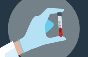 How Much Does it Cost To Test Insulin? insulin test price