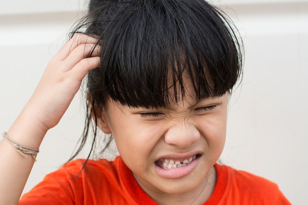 a child infected with head lice