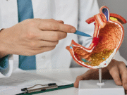 A Comprehensive Guide to Gastric Bypass Surgery Gastric Bypass Surgery