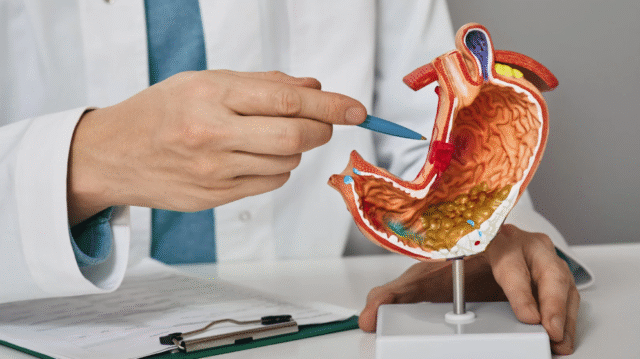 Gastric Bypass Surgery