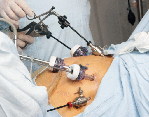 How Gastric Bypass Surgery Can Help You Achieve Sustainable Weight Loss gastric bypass surgery